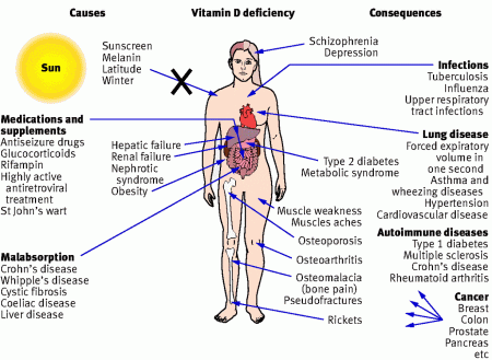 vitamin D and muscle pain