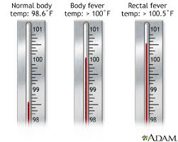 temperature