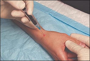 cortisone shot in hand