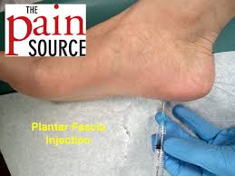 cortisone injection in foot